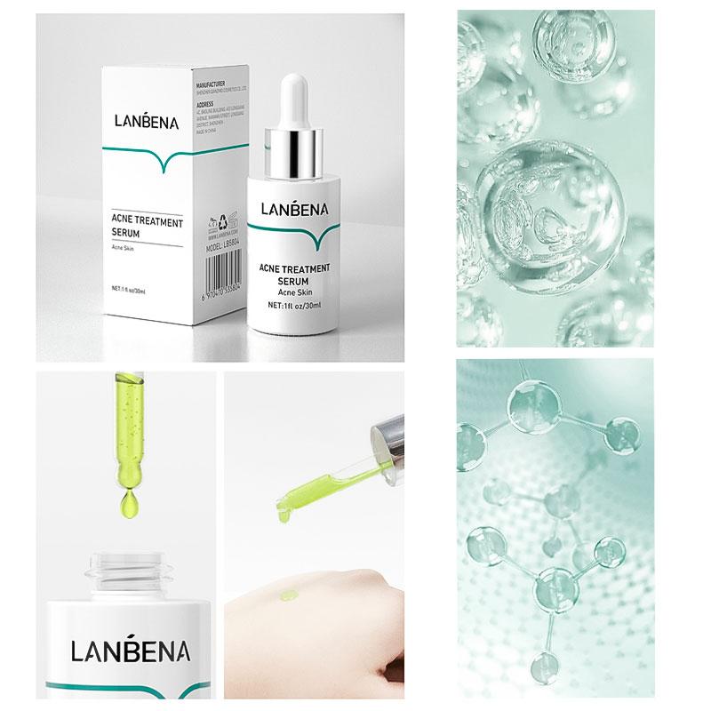 Сыворотка для лечения акне LANBENA Acne Treatment Serum 30 мл для проблемной кожи KU_22 - фото 6 - id-p1719702800