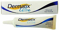 Дерматикс ультра (Dermatix Ultra) США - гель для лікування рубців та шрамів (15 г)