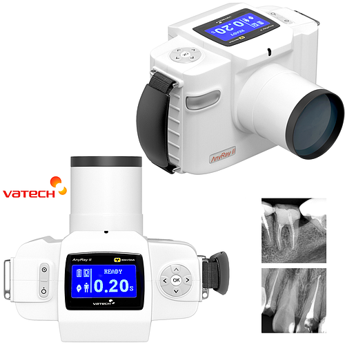 Купить Портативный Рентген Аппарат VATECH ANYRAY II, цена 89700 грн ...