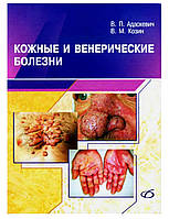 Шкіряні та венеричні хвороби Адаскевич В.П. 2006г. чб