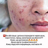 Тонік з АНА ВНА кислотами та рослинними екстрактами, Джерелія, 100 мл, фото 6