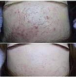 Тонік з АНА ВНА кислотами та рослинними екстрактами, Джерелія, 100 мл, фото 3