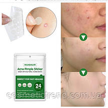Пластирі/патчі від прищів лікувальні невидимі West&Month Acne Pimple Patch 36 шт., фото 5