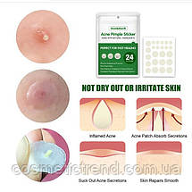 Пластирі/патчі від прищів лікувальні невидимі West&Month Acne Pimple Patch 36 шт., фото 4