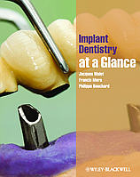 Основи імплантології Малет/Implant Dentistry Jacques Malet