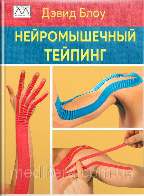 Нейром'язовий тейпінг. Від теорії до практики. Девід Блоу.