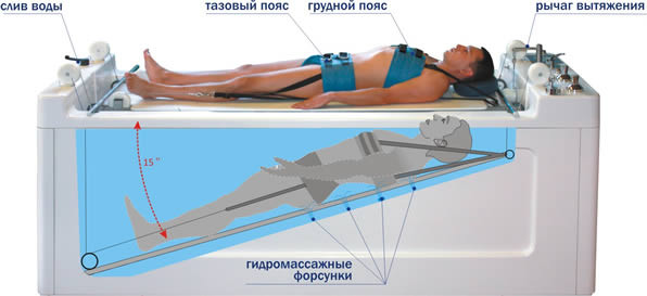 Акватракцион - гідромасажна ванна для підводного витягування і гідромасажу хребта