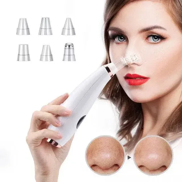 Очищення обличчя, Вакуумний апарат для чищення шкіри обличчя та пор Multi-Functional, апарат для чищення пор обличчя