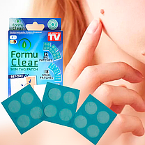 Пластир від папілом 12+18 FORMU CLEAR, Засіб від папілом і бородавок, фото 3