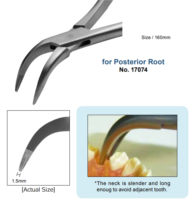 Щипці для видалення коренів задніх зубів, Type 2  (YDM)