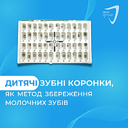 Дитячі зубні коронки, як метод збереження молочних зубів