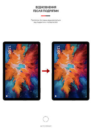 Гідрогелева плівка ArmorStandart для Umidigi A11 Tab (ARM65355) прозора, фото 3