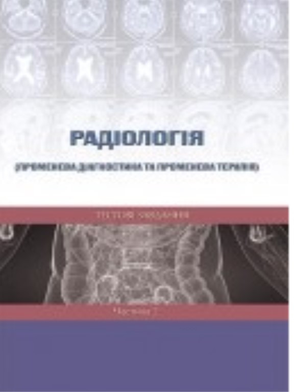 Радіологія (променева діагностика та променева терапія). Тестові завдання. Частина 2. Ткаченко М.