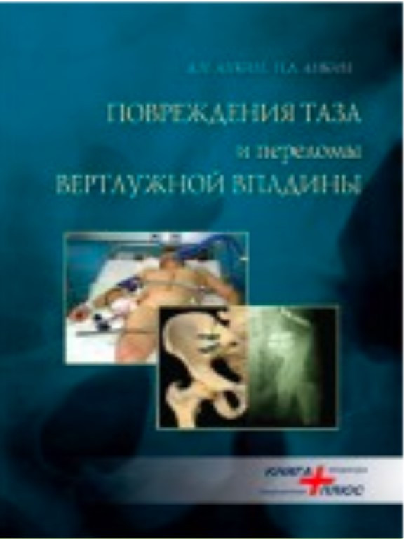 Повреждения таза и переломы вертлужной впадины. Анкин Н.Л., Анкин Л.Н.