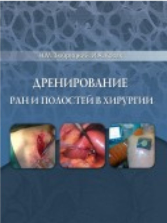 Дренирование ран и полостей в хирургии. Зюбрицкий Н.М.