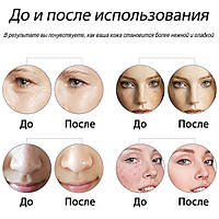 Мезороллер 450 Microneedles, отличный товар