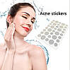 Пластир від прищів Acne Patch, фото 3