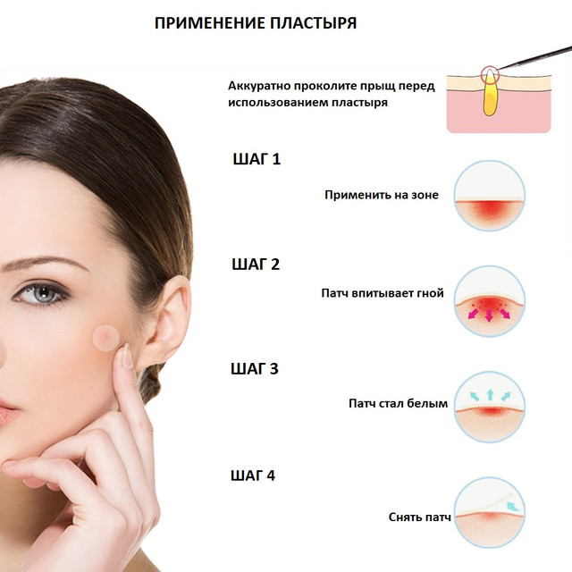 Как использовать пластырь от прыщей