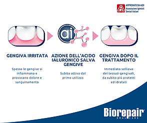 Зубна паста Biorepair PERIBIOMA Gentive ЗАХИСТ ДЕСЕН 75 мл, фото 2