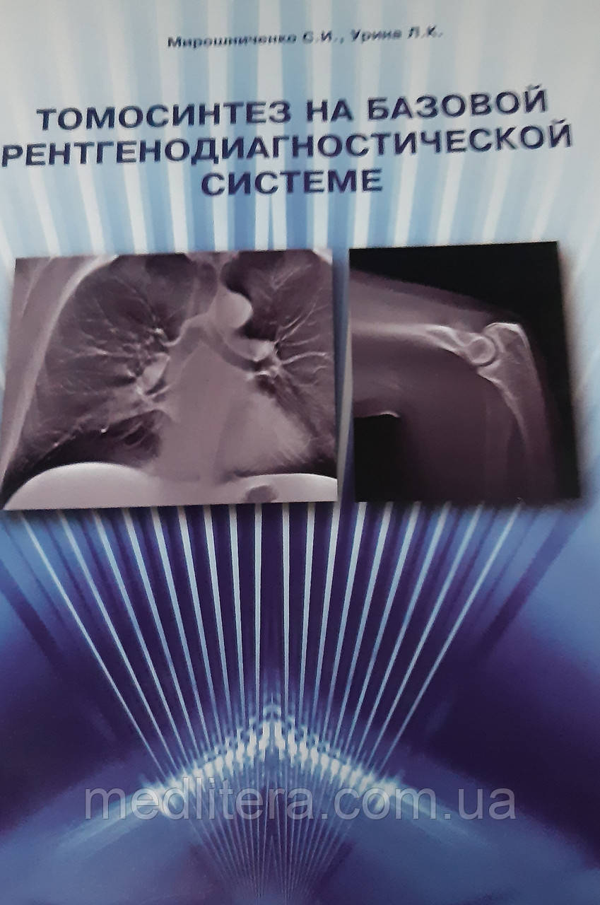 Урина Л.К., Мироченко С.І. Томосинтез на базовій рентгенівсько-позичній системі., фото 1