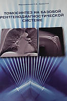 Урина Л.К., Мироченко С.І. Томосинтез на базовій рентгенівсько-позичній системі.