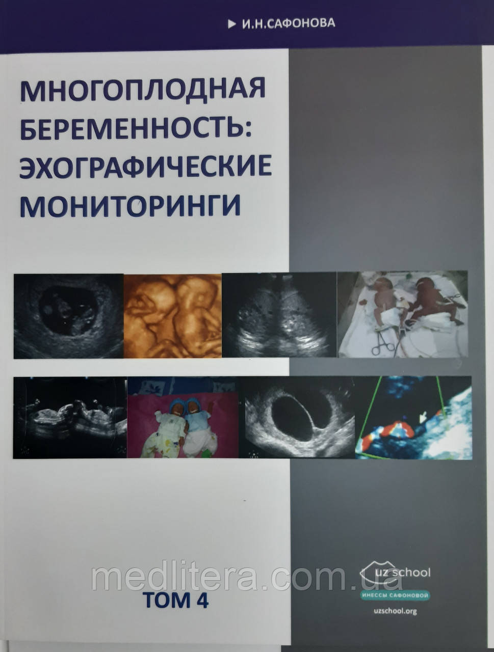 Сафонова. І. М. Багатоплідна вагітність: лунографічні моніторинги. том 4