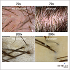 ТРИХОСКОП для трихоскопії та аналізу волосся TrichoScope Polarizer (MEDL4HM), фото 4