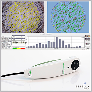 Трихоскоп цифровий професійний TrichoScan HD 4.0. з аналітичною програмою, Німеччина