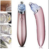 Вакуумний апарат для чищення пор xn-8030, фото 2