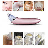 Вакуумний апарат для чищення пор xn-8030, фото 4