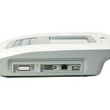 Електрокардіограф 3-х канальний 1103L Медапаратура, фото 5