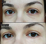 Гідрогелеві детокс-патчі Bio World від темних кіл і мішків під очима 60 шт, фото 3