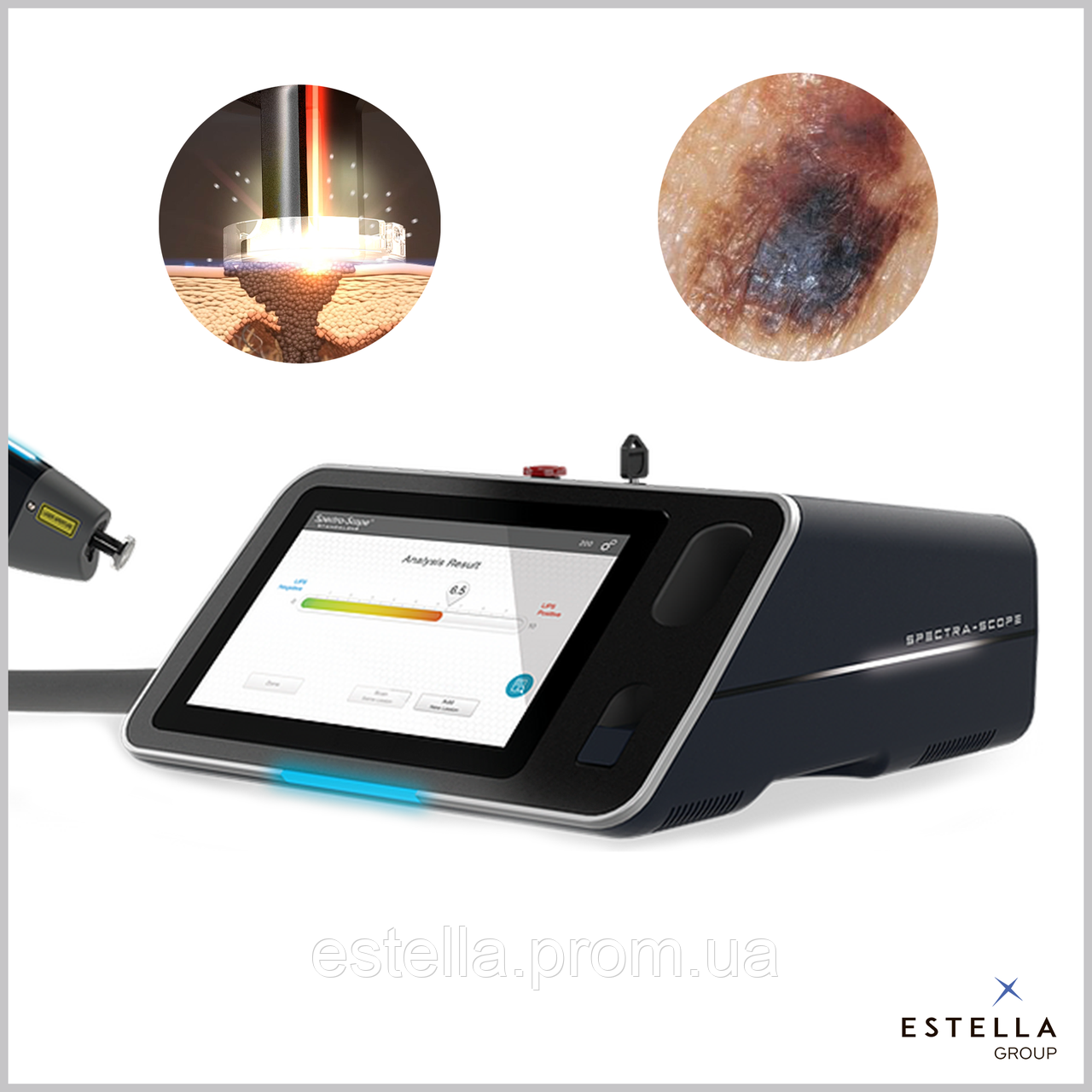 Spectra-Scope® - пристрій для діагностики раку шкіри, США