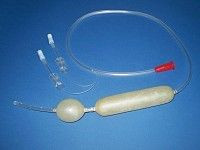 Стравохідний Зонд типу Блекмор (зонд Блекмора), фото 1