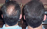 Маскувальна кератинова пудра/загусник для волосся (корекція залисин) Toppik medium brown 55 грамів, фото 3
