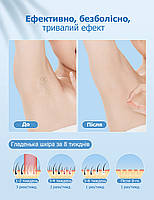 Фотоепілятор IPL Ice Cool Hair Removal BH03 з охолодженням - домашній лазерний епілятор для видалення волосся, фото 5