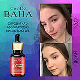 Сироватка для обличчя з азелаїновою кислотою проти акне та запалень Cos De BAHA Azelaic Acid 10% Serum 30 мл, фото 4