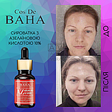 Сироватка для обличчя з азелаїновою кислотою проти акне та запалень Cos De BAHA Azelaic Acid 10% Serum 30 мл, фото 7