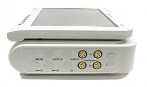 Монітор фетальний С21 (“БІОМЕД” BF500), фото 3