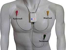 SDM3 (Холтер ЕКГ), фото 3