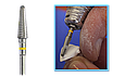 Набір фрез для обробки сирого циркону Yeti Dental (Німеччина), фото 4