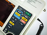 Б/У Дефібрилятор з монітором і кабелем пацієнта ЕКГ Medtronic Physio Control LIFEPAK 12 Defibrillator (Used), фото 4