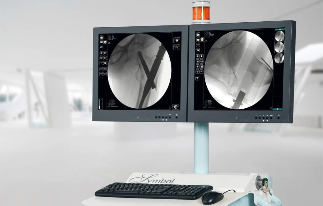 Хирургические рентгеновские системы типа C-дуга GMM Symbol 10R13 - фото 6 - id-p1777318191
