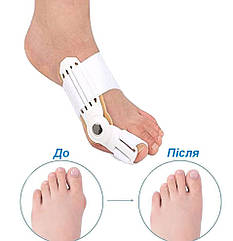 Бандаж шина коректор великого пальця Bunion Aid Hinged Splint for Bunions