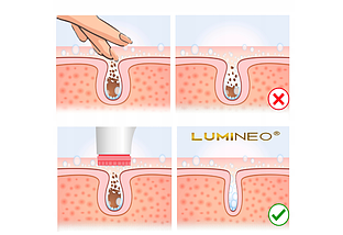 Щіточка для очищення обличчя Lumineo Brush pink + гель-спа, фото 3