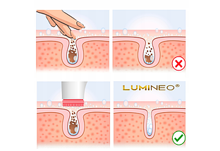 Щіточка для очищення обличчя Lumineo Brush pink + гель-спа, фото 6