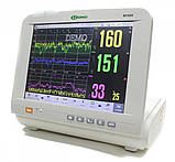 Монітор фетальний для двійні BF500 Медапаратура, фото 4