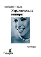 Керамические виниры. Искусство и наука Галип Гюрель 2007г.