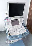 Апарат ультразвукової діагностики Ultrasonograf TOSHIBA Xario SSA-660A, фото 3