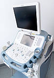 Апарат ультразвукової діагностики Ultrasonograf TOSHIBA Xario SSA-660A, фото 9